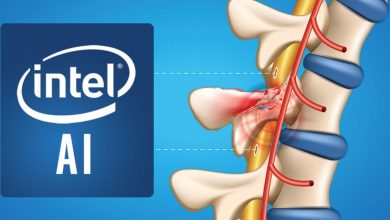 Intel Hasarlı Spinal Sinirleri Yapay Zeka İle İyileştirmek İstiyor
